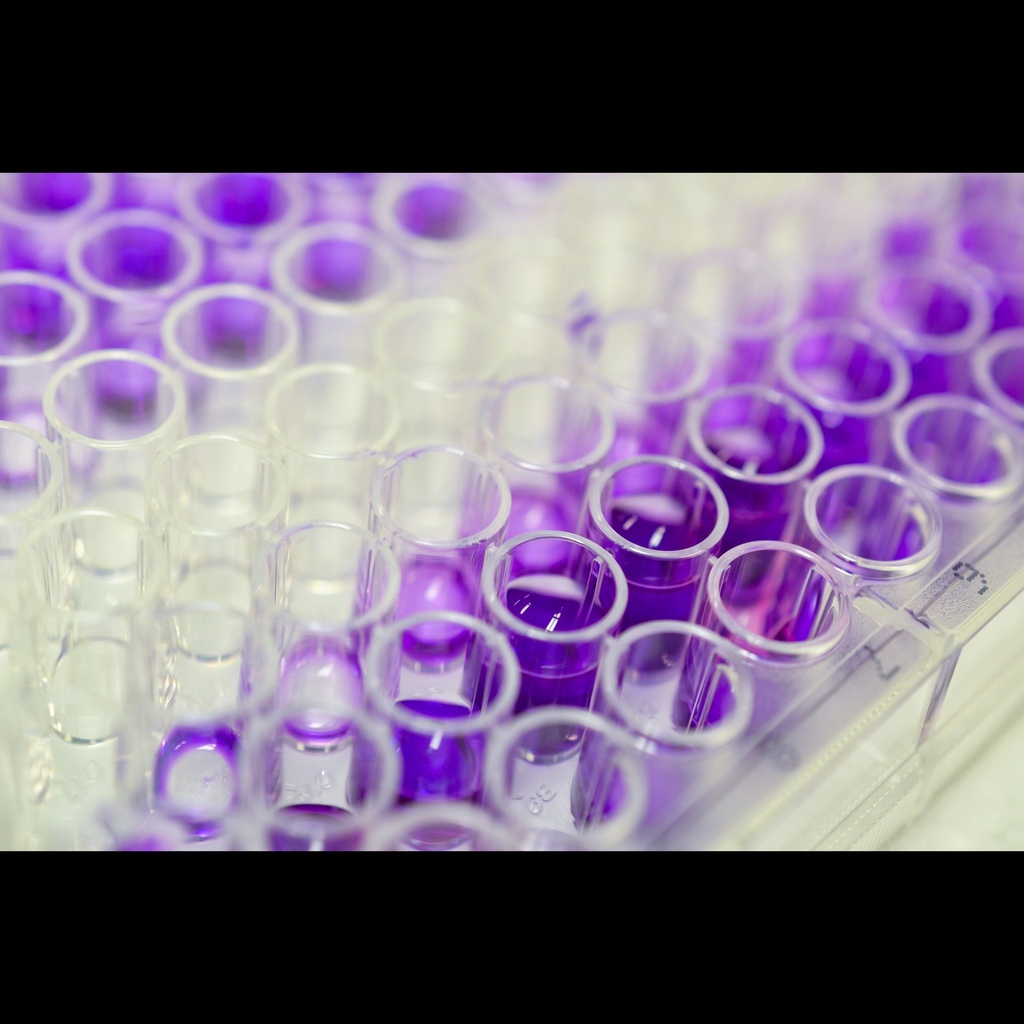 Bovine ELISA Kit for Tumor Necrosis Factor Alpha  TNFa 
